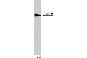 Western blot analysis of PKR on a A431 cell lysate (Human epithelial carcinoma, ATCC CRL-1555). (EIF2AK2 Antikörper  (AA 117-250))