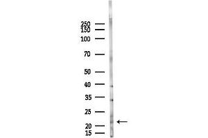 anti-COMM Domain Containing 3 (COMMD3) antibody