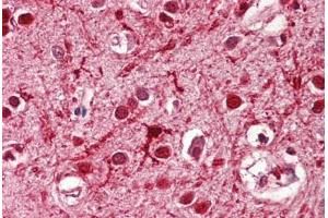 Image no. 2 for anti-Achaete-Scute Complex Homolog 3 (ASCL3) (AA 118-130) antibody (ABIN1495987) (ASCL3 Antikörper  (AA 118-130))
