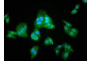 Immunofluorescence staining of HepG2 cells with ABIN7157906 at 1:100, counter-stained with DAPI. (LANCL2 Antikörper  (AA 2-106))