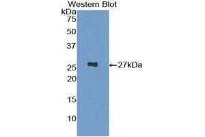 Western Blotting (WB) image for anti-Glutathione S-Transferase pi 1 (GSTP1) (AA 1-210) antibody (ABIN1078088)