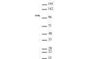 Mili / PiwiL2 antibody (rAb) tested by Western blot. (Rekombinanter PIWIL2 Antikörper)