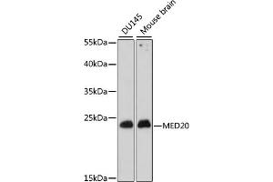 Western blot analysis of extracts of various cell lines, using MED20 antibody (ABIN7268441) at 1:1000 dilution.