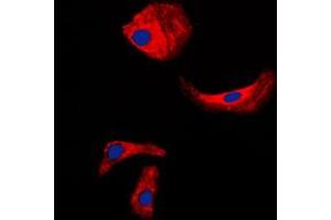Immunofluorescent analysis of Kallikrein 3 staining in LNCaP cells. (Prostate Specific Antigen Antikörper  (Center))