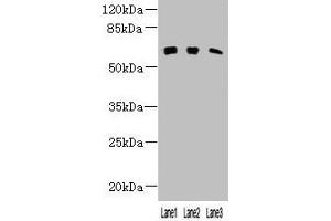 Western blot All lanes: KLHL23 antibody at 3 μg/mL Lane 1: Mouse lung tissue Lane 2: Human placenta tissue Lane 3: HL60 whole cell lysate Secondary Goat polyclonal to rabbit IgG at 1/10000 dilution Predicted band size: 64 kDa Observed band size: 64 kDa (KLHL23 Antikörper  (AA 1-200))