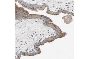Immunohistochemical staining of human skeletal muscle with XYLT1 polyclonal antibody  shows moderate cytoplasmic positivity at 1:20-1:50 dilution. (XYLT1 Antikörper)