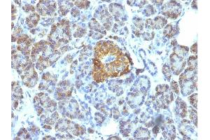 Immunohistochemistry (IHC) image for anti-Heat Shock 60kDa Protein 1 (Chaperonin) (HSPD1) antibody (ABIN6939665)