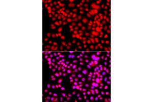Immunofluorescence analysis of A549 cell using THAP1 antibody. (THAP1 Antikörper)