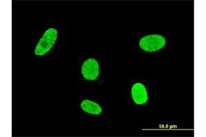 Immunofluorescence of monoclonal antibody to GSC on HeLa cell. (GSC Antikörper  (AA 151-257))