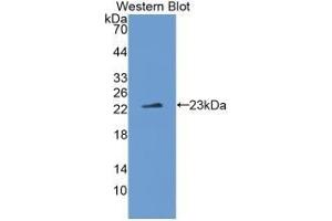 Detection of Recombinant IL1z, Human using Monoclonal Antibody to Interleukin 1 Zeta (IL1z) (IL-37 Antikörper  (AA 27-192))