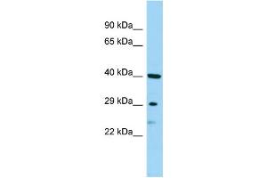 WB Suggested Anti-SBSN Antibody Titration: 1. (Suprabasin Antikörper  (Middle Region))