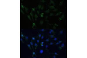 Immunofluorescence analysis of C6 cells using ZWINT Polyclonal Antibody (ABIN6128944, ABIN6150552, ABIN6150554 and ABIN6221938) at dilution of 1:100 (40x lens). (ZWINT Antikörper  (AA 1-277))