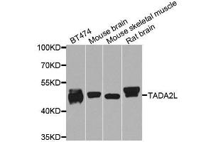 Western blot analysis of extracts of various cell lines, using TADA2A antibody. (TADA2L Antikörper  (AA 1-443))