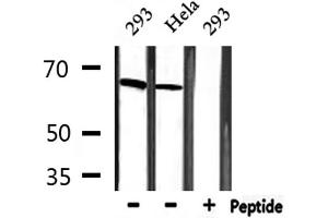 Western blot analysis of extracts from 293 and Hela, using MBD1 Antibody.