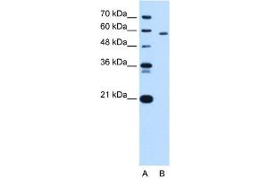 PKLR antibody used at 5 ug/ml to detect target protein. (PKLR Antikörper  (N-Term))