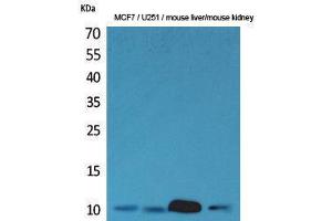 Western Blotting (WB) image for anti-Diazepam Binding Inhibitor (DBI) (C-Term) antibody (ABIN3187735)