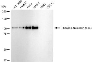 Western blotting analysis using Phospho-Nucleolin (T84) antibody (ABIN7799670).