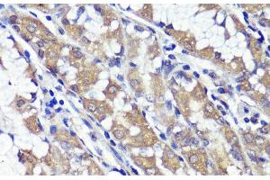 Immunohistochemistry of paraffin-embedded Human stomach using UBL3 Polyclonal Antibody at dilution of 1:100 (40x lens). (UBL3 Antikörper)