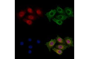 ABIN7094461 and ABIN7098509 staining HepG2 cells by IF/ICC. (CENPB Antikörper  (N-Term))