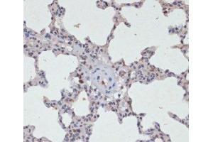 Immunohistochemistry of paraffin-embedded Rat lung using Phospho-Jak2(Y1007/1008) Polyclonal Antibody at dilution of 1:200 (40x lens). (JAK2 Antikörper  (pTyr1007, pTyr1008))