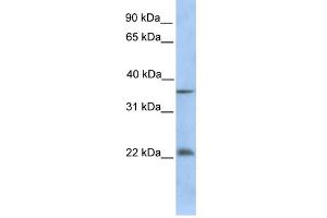 WB Suggested Anti-RYBP Antibody Titration:  0. (RYBP Antikörper  (C-Term))