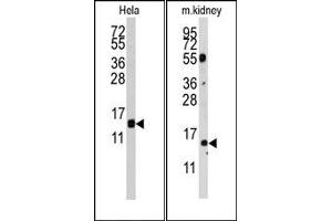 Image no. 1 for anti-Cytidine Deaminase (CDA) (AA 59-89) antibody (ABIN358053) (CDA Antikörper  (AA 59-89))