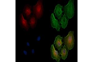 ABIN6258918 and ABIN6274669 staining  cells by IF/ICC.
