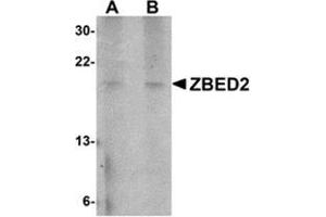 Western blot analysis of ZBED2 in A549 cell lysate with this product at (A) 1 and (B) 2 μg/ml. (ZBED2 Antikörper  (N-Term))