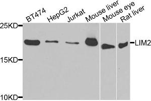 Western blot analysis of extracts of various cell lines, using LIM2 antibody. (LIM2 Antikörper)
