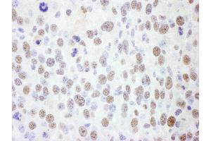 Immunohistochemistry (IHC) image for anti-Structural Maintenance of Chromosomes 1A (SMC1A) (AA 1183-1233) antibody (ABIN7454968) (SMC1A Antikörper  (AA 1183-1233))