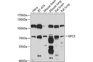 Western blot analysis of extracts of various cell lines, using GPC5 antibody (ABIN6127989, ABIN6141313, ABIN6141314 and ABIN6214656) at 1:1000 dilution. (GPC5 Antikörper  (AA 320-550))