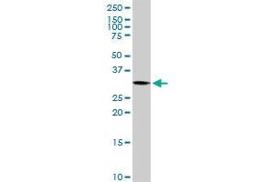 PYCR1 MaxPab rabbit polyclonal antibody. (PYCR1 Antikörper  (AA 1-319))