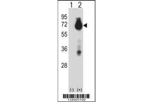 Western blot analysis of BIRC3 using rabbit polyclonal BIRC3 Antibody using 293 cell lysates (2 ug/lane) either nontransfected (Lane 1) or transiently transfected (Lane 2) with the BIRC3 gene. (BIRC3 Antikörper  (N-Term))