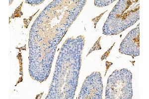 Phospho-eIF4E (Thr55) Antibody at 1/100 staining Mouse testis tissue by IHC-P. (EIF4E Antikörper  (pThr55))