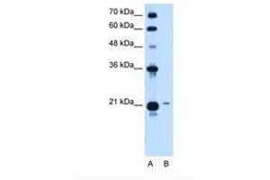 Image no. 2 for anti-T-Complex 10 (TCP10) (AA 109-158) antibody (ABIN321002) (TCP10 Antikörper  (AA 109-158))