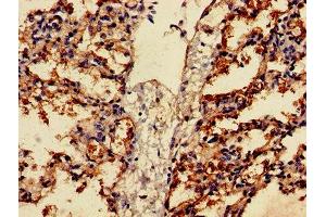Immunohistochemistry of paraffin-embedded human lung tissue using ABIN7153163 at dilution of 1:100 (FFAR2 Antikörper  (AA 277-330))