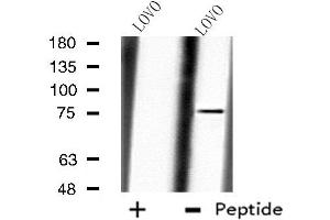 Western blot analysis of extracts from LOVO cells, using CAPN10 antibody. (CAPN10 Antikörper  (N-Term))