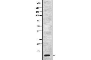 Western blot analysis of CCK using NIH-3T3 whole cell lysates (Cholecystokinin Antikörper  (Internal Region))