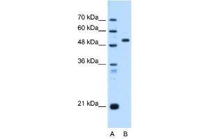 ST14 antibody used at 0.