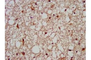 IHC image of ABIN7159209 diluted at 1:200 and staining in paraffin-embedded human brain tissue performed on a Leica BondTM system. (MC3R Antikörper  (AA 38-74))