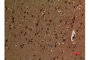 Immunohistochemistry (IHC) image for anti-Ubiquitin (Ub) (acLys27) antibody (ABIN3181496)
