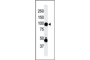 The anti-P4K2 Pab (ABIN391081 and ABIN2841226) is used in Western blot to detect P4K2 in mouse skeletal muscle tissue lysate. (MAP4K2 Antikörper  (AA 288-319))