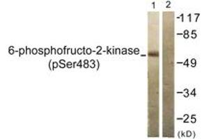 Western blot analysis of extracts from 293 cells treated with Heat shock, using PFKFB2 (Phospho-Ser483) Antibody. (PFKFB2 Antikörper  (pSer483))