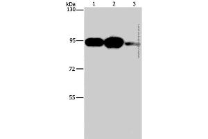 Western Blot analysis of Mouse stomach tissue, 293T and Jurkat cell using PLA2G4B Polyclonal Antibody at dilution of 1:1400 (PLA2G4B Antikörper)