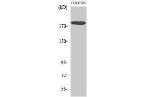 Western Blotting (WB) image for anti-MAP-Kinase Activating Death Domain (MADD) (Internal Region) antibody (ABIN3180153) (MADD Antikörper  (Internal Region))