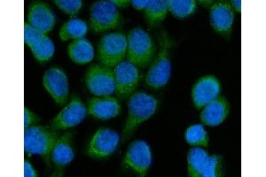 anti-Saccharopine Dehydrogenase (SCCPDH) (AA 2-241) antibody