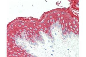 Anti-KRT10 / CK10 / Cytokeratin 10 antibody IHC staining of human skin. (Keratin 10 Antikörper  (AA 150-179))
