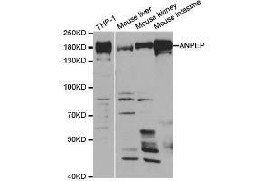 Western blot analysis of extracts of various cell lines, using ANPEP antibody. (CD13 Antikörper  (AA 668-967))