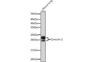 Western blot analysis of extracts of Mouse lung, using Caveolin-2 Rabbit mAb (ABIN7266155) at 1:1000 dilution. (Caveolin 2 Antikörper)