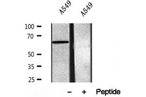 Western blot analysis of extracts of A549 cells, using SQLE antibody. (SQLE Antikörper  (C-Term))